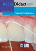 Nazorg bij implantaten (Paperback)