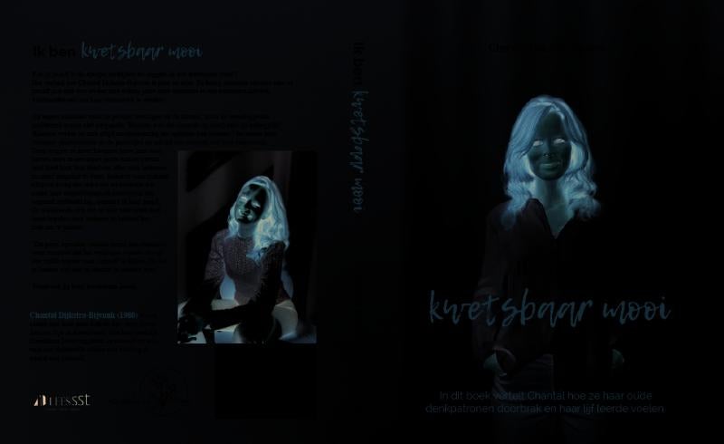 Ik ben kwetsbaar mooi (Paperback)