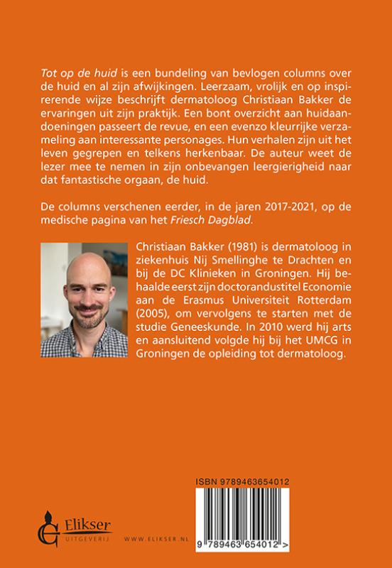 Tot op de huid (Paperback) Tot op de huid (Paperback)